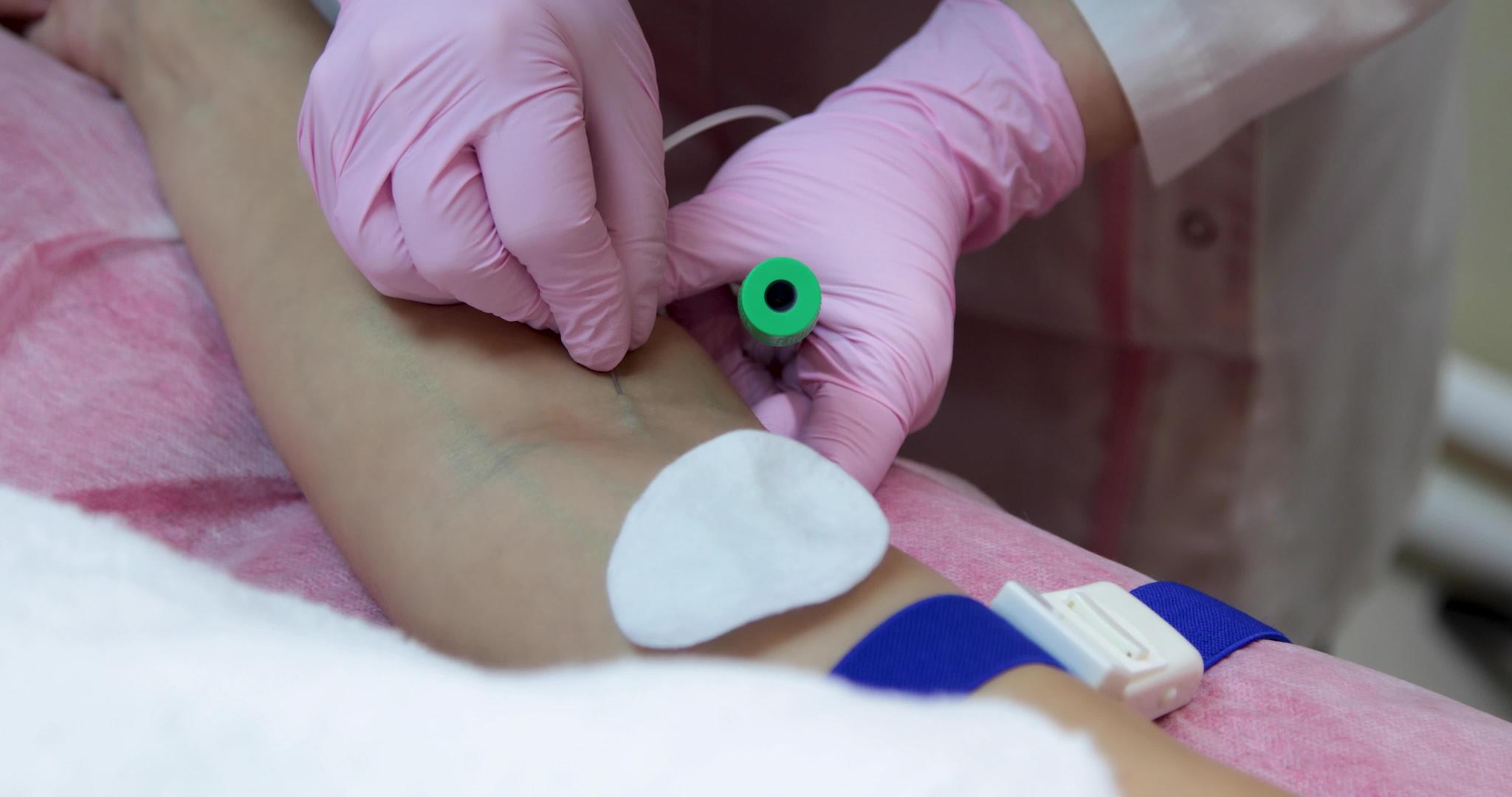 温泉疗养专家从血管中提取血液用于等离子体升降视频的预览图