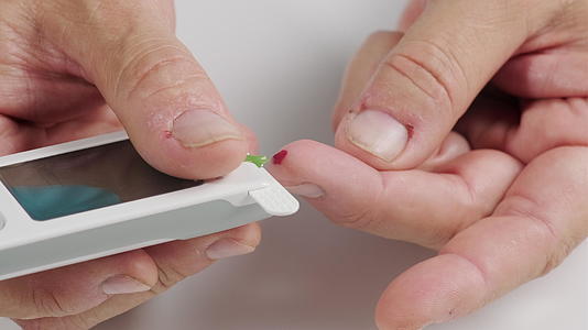 从手指取血到测量血糖的过程男人的手拿着显示器视频的预览图