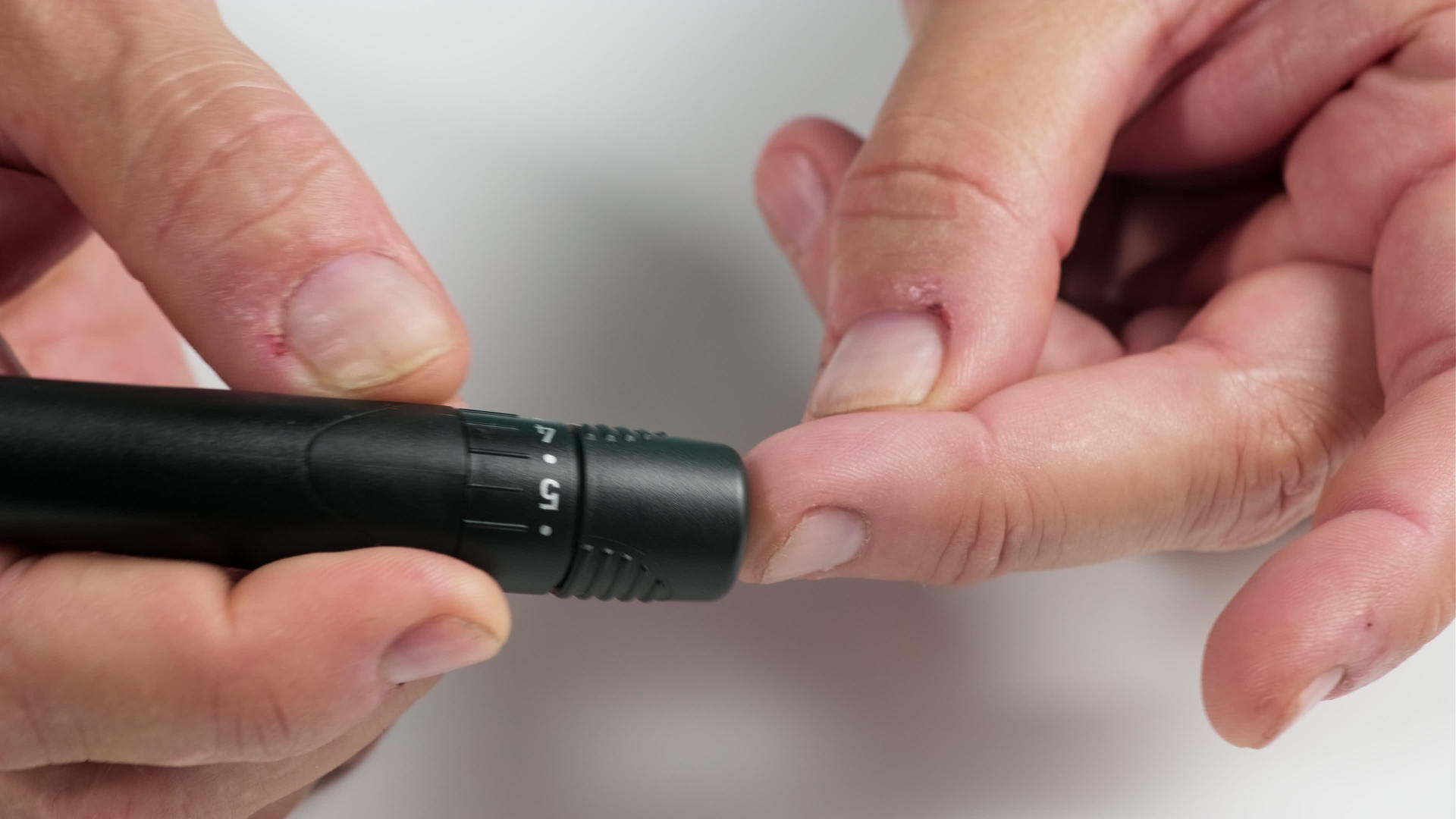 男人用针刺及时检查和预防他的血糖视频的预览图