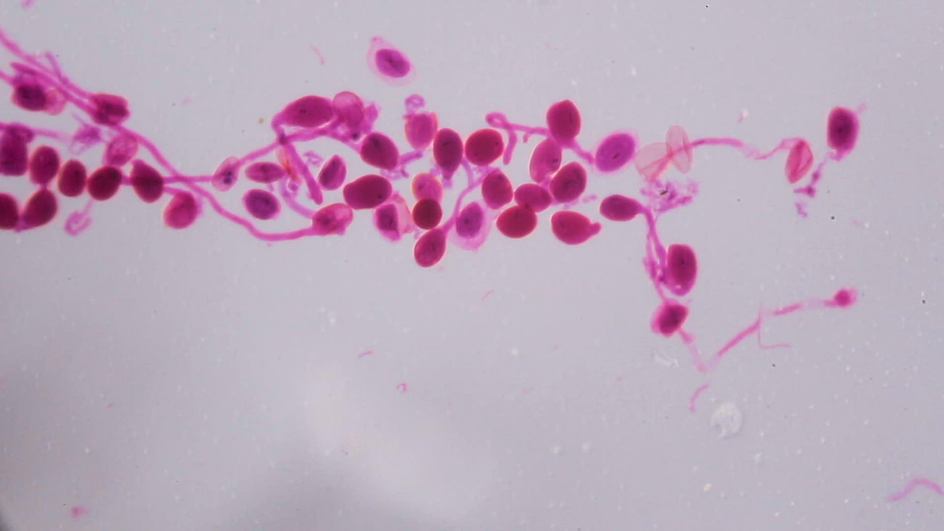 在显微镜下白色背景上的抽象粉色点成熟了视频的预览图