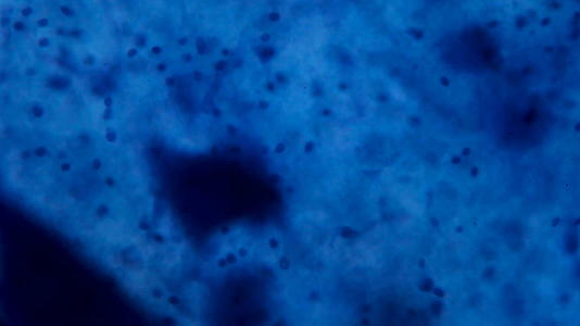 显微镜下神经元细胞白色背景上的抽象蓝点视频的预览图