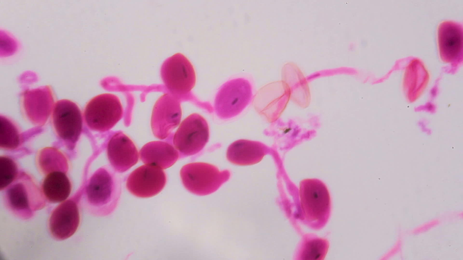在显微镜下白色背景上的抽象粉色点成熟了视频的预览图