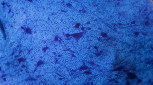 显微镜下神经元细胞白色背景上的抽象蓝点视频的预览图