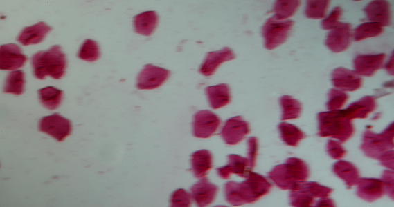 口服黏膜粘膜染色细胞与细胞核和细菌视频的预览图