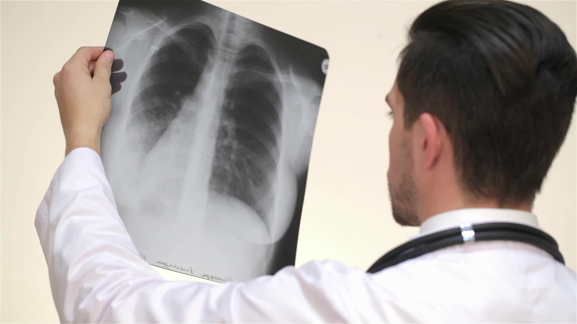 医生检查背部的X光视图视频的预览图