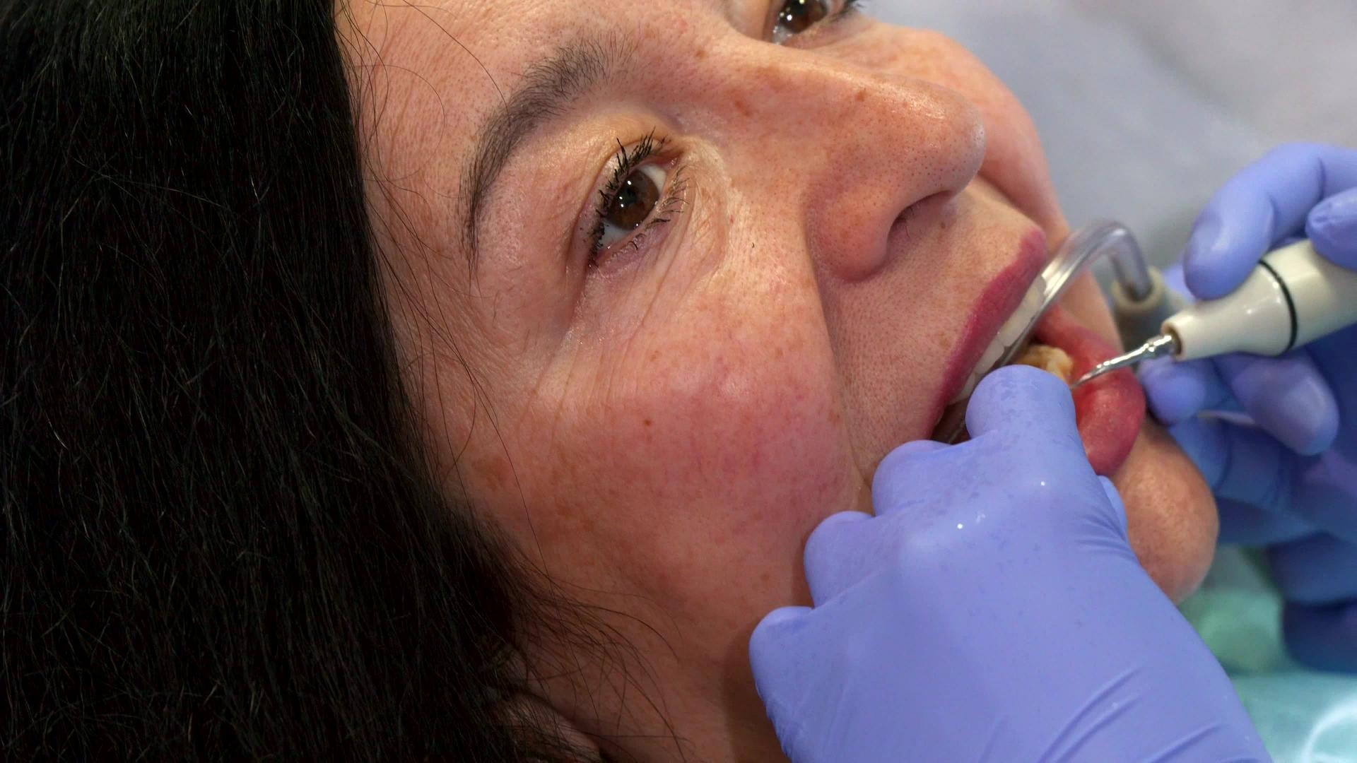 女性进行深层牙科清洁视频的预览图