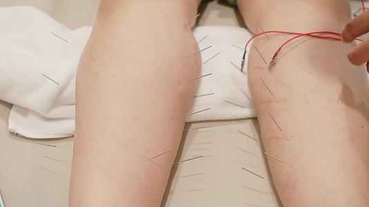 女性在双腿上使用电力插针视频的预览图