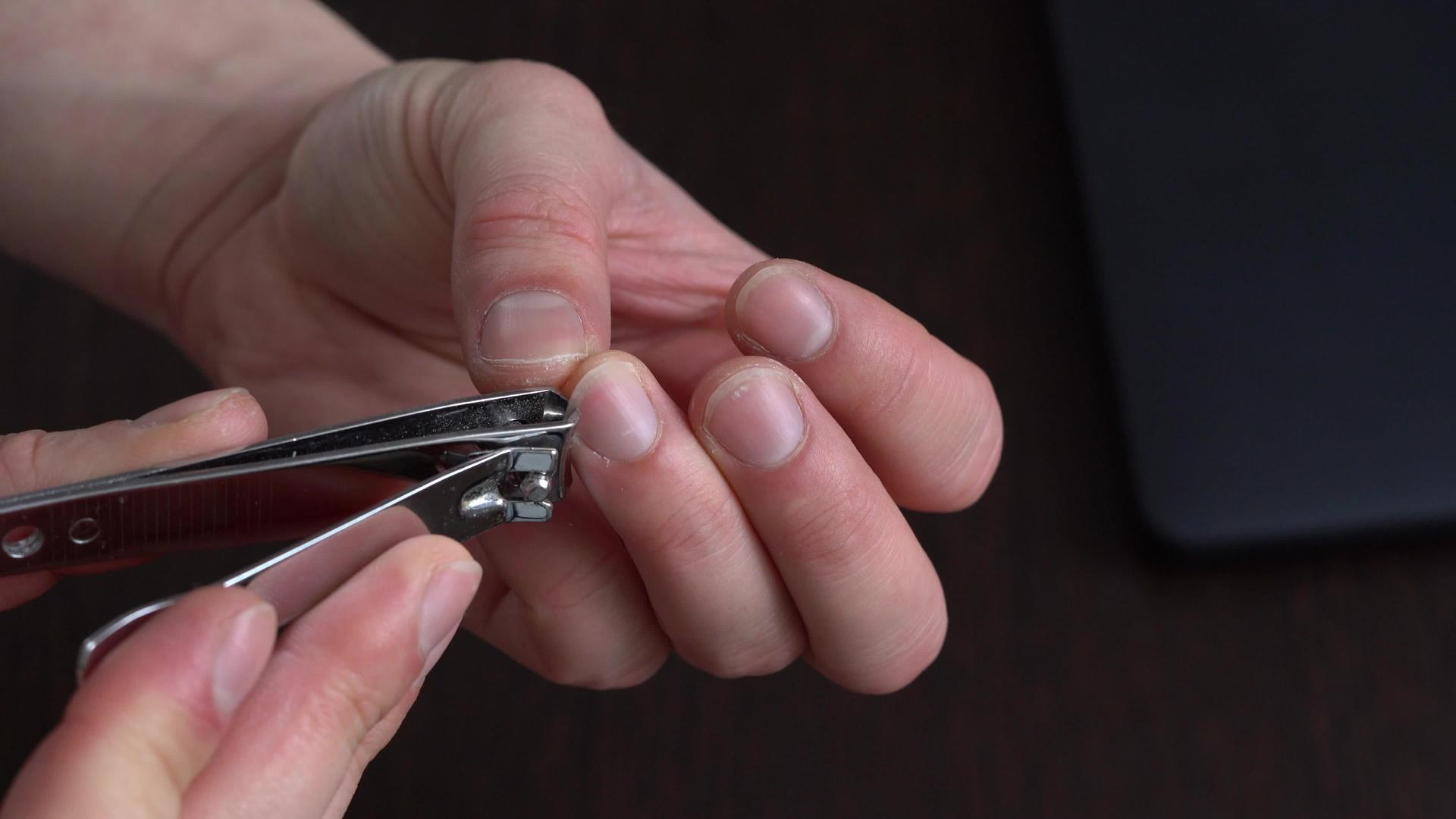 个人卫生用tweezers剪指甲视频的预览图