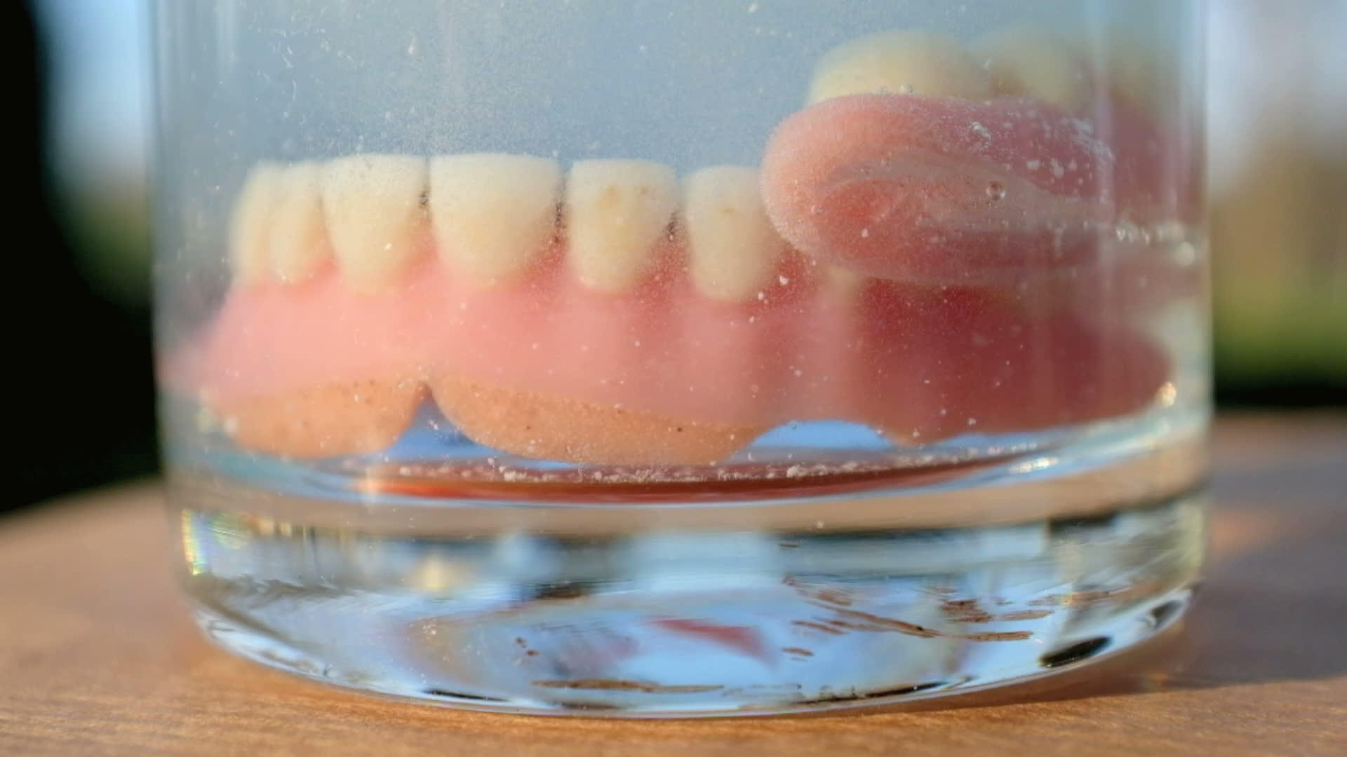 医用假牙颌牙视频的预览图