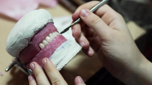 牙科技术人员从工作器上去除多余的蜡和粉红色的牙蜡视频的预览图