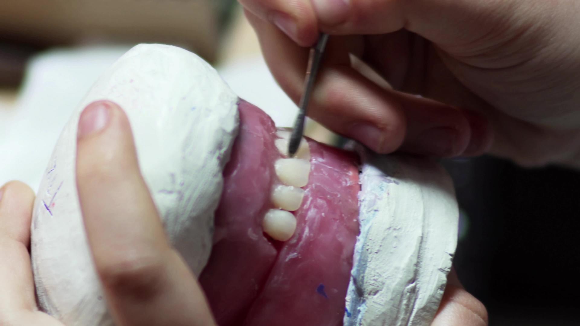 牙齿假牙模型牙医工作视频的预览图