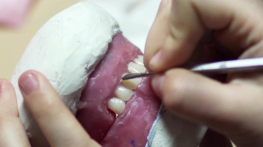 假牙实验室粘牙模型模型视频的预览图
