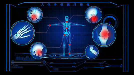 4Ｋ人体骨骼病症演示模板视频的预览图