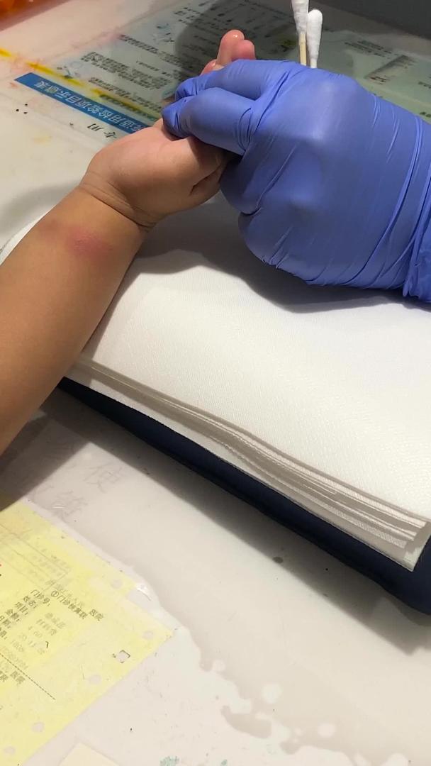 实拍护士对儿童手指进行血液检查验血视频的预览图