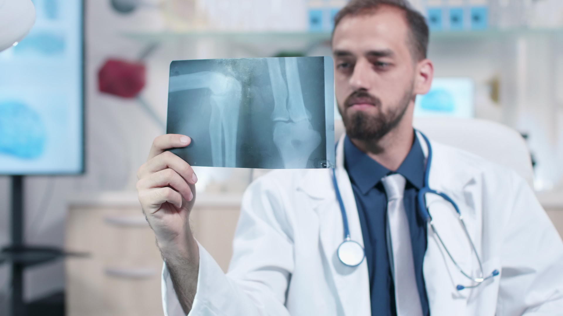 医生看腿部x射线扫描光片视频的预览图
