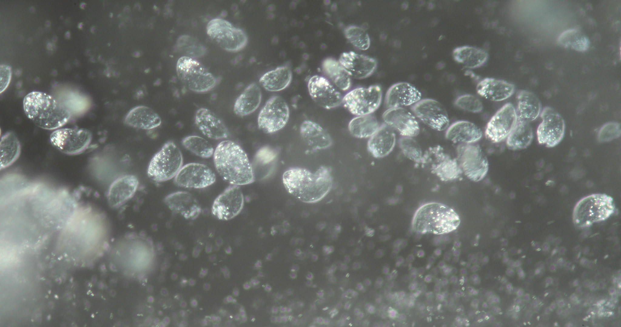 硅基和细菌在显微镜下的废水和细菌视频的预览图