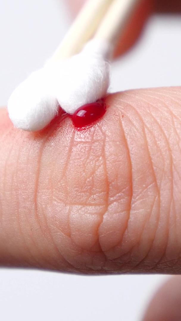 流血伤口处理擦碘伏消毒视频的预览图