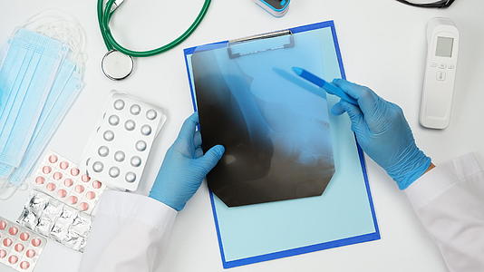 蓝色手套医生拿着骨头x光片检查桌子顶部的慢动作视频的预览图