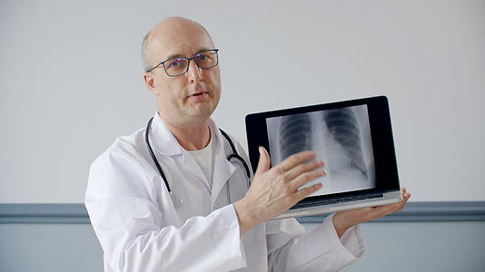 膝上医生用X光显示肺部和诊断结果视频的预览图