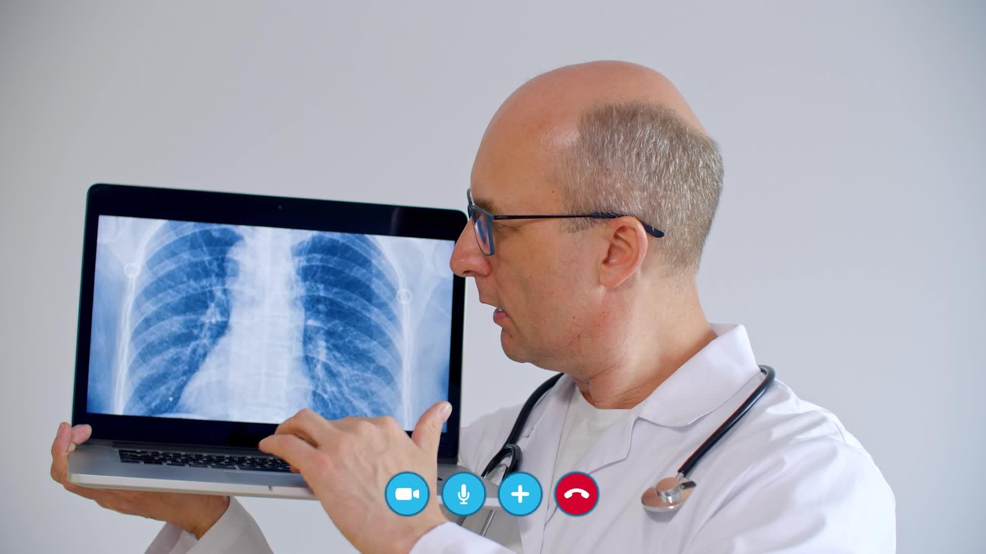 在视频聊天中医生使用肺部x光图像视频的预览图