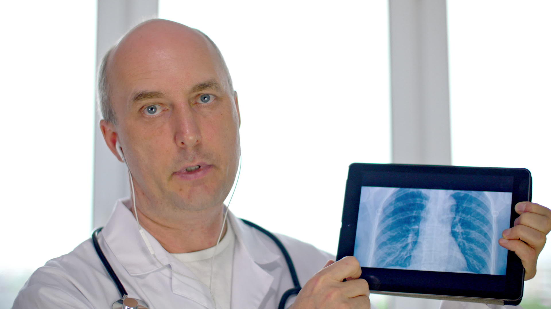 医生显示带有X光肺的数字平板片视频的预览图