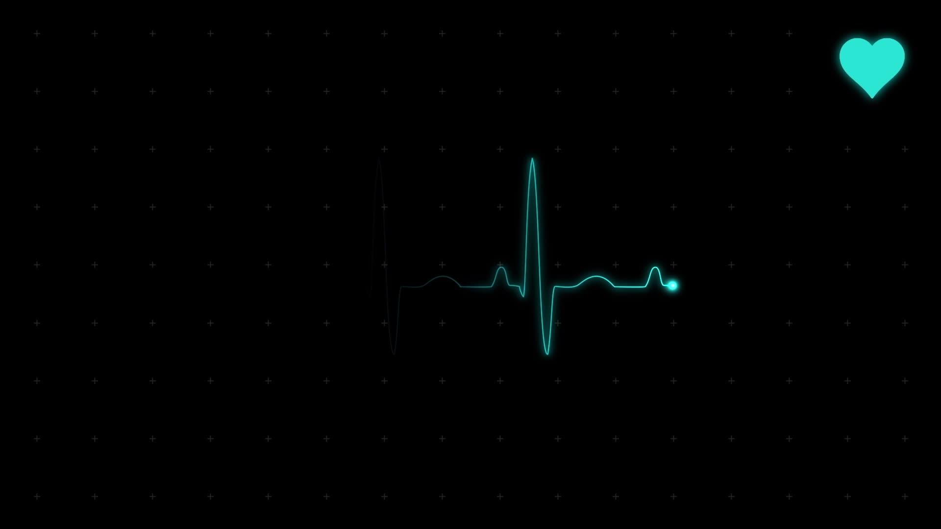 医疗设备屏幕上的心电图心电图视频的预览图