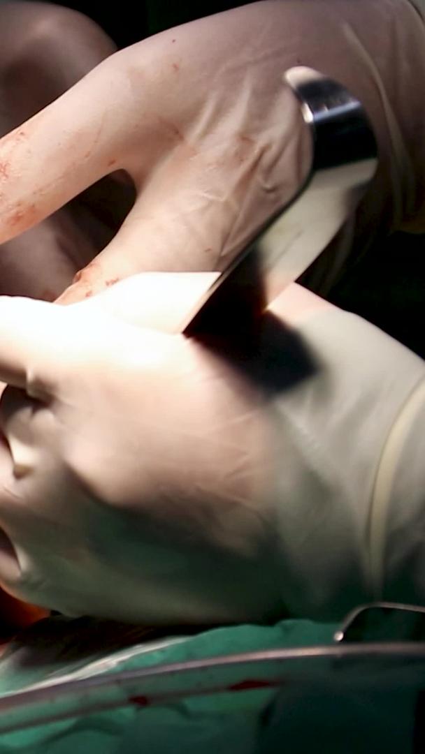 实拍医院手术室缝合伤口场景视频的预览图