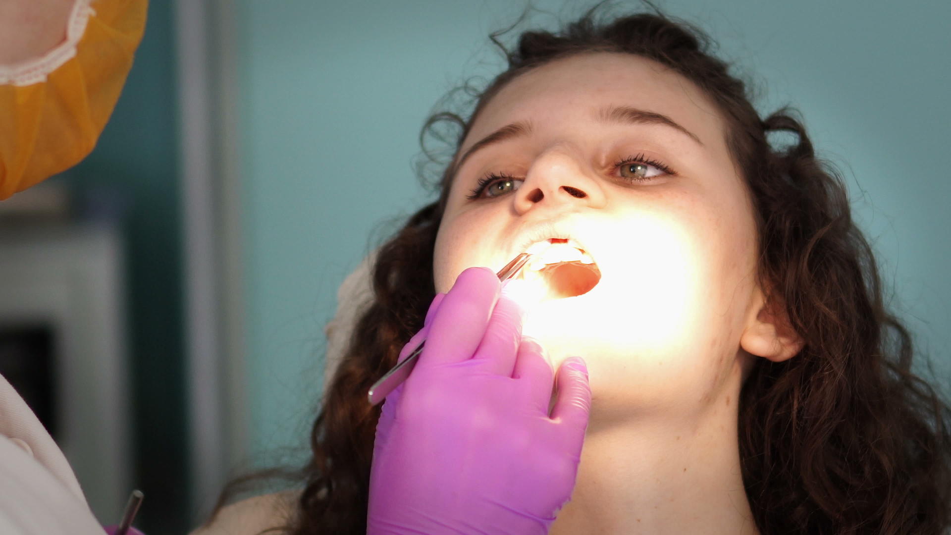 在患者牙齿上工作的女性牙齿牙医视频的预览图