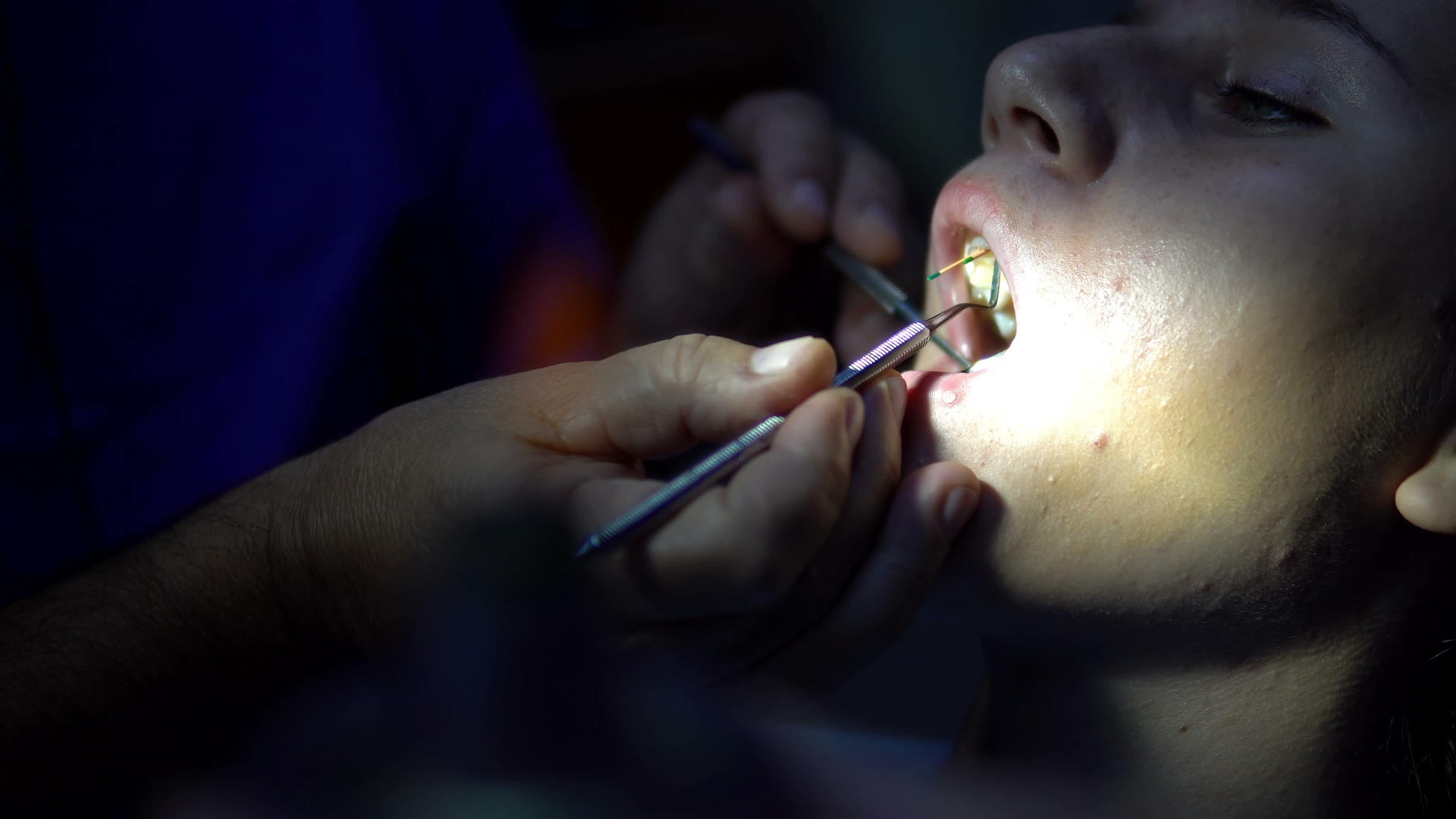 在申请内肠牙洞填充期间在牙科医生那里看女牙医视频的预览图