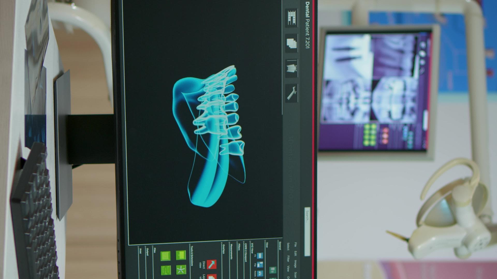 垂直视频空牙科医疗室电脑上的数字X光片视频的预览图