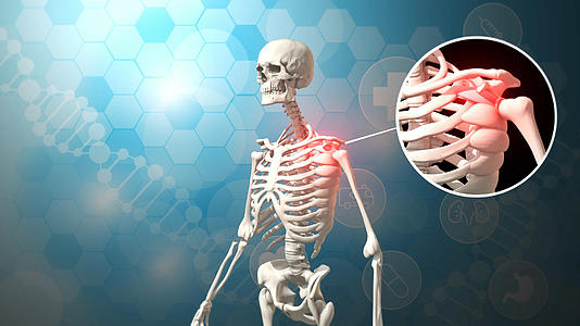 4K三维科技医疗肩周炎背景视频的预览图