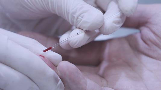 医生用手收集血样进行体检视频的预览图