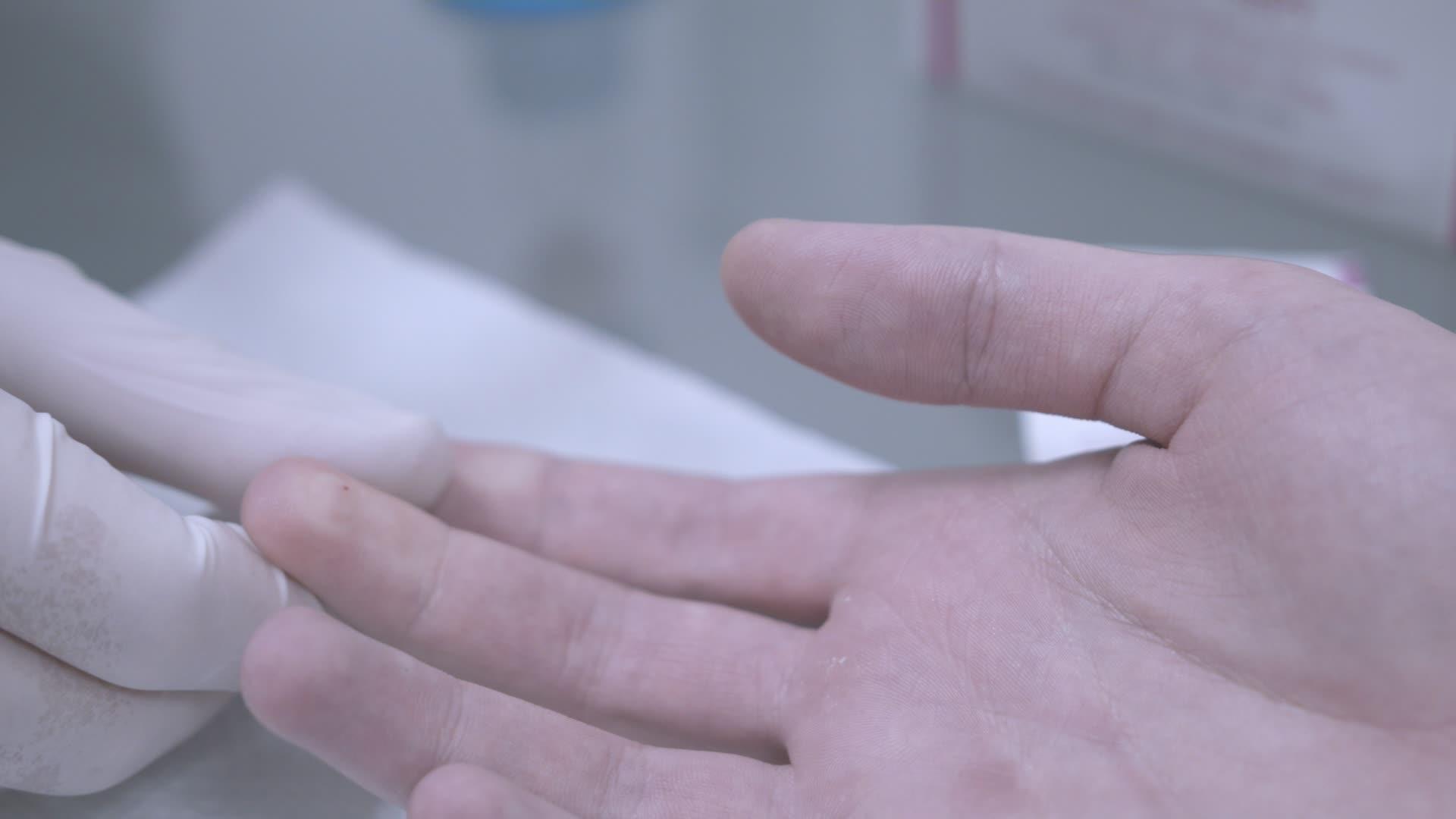 用手指穿刺采集血样医用注射视频的预览图
