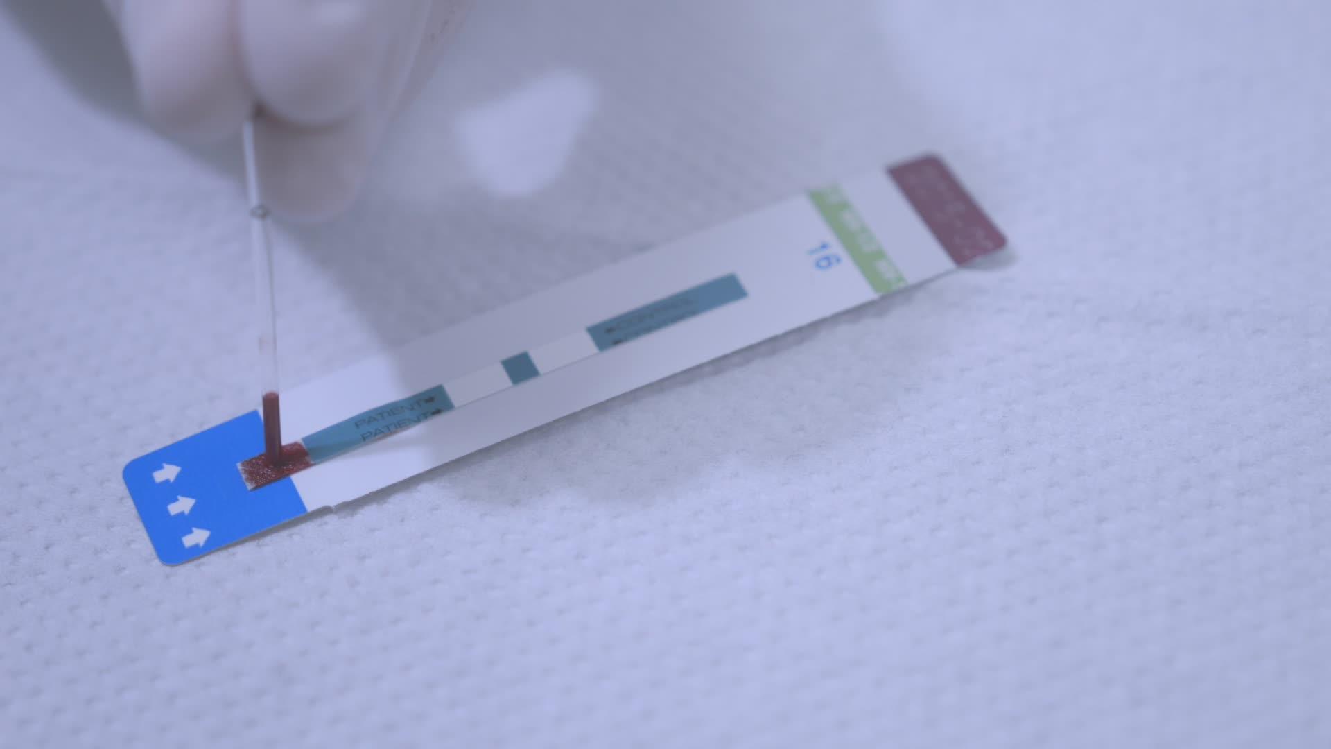 试验血带检查快感视频的预览图