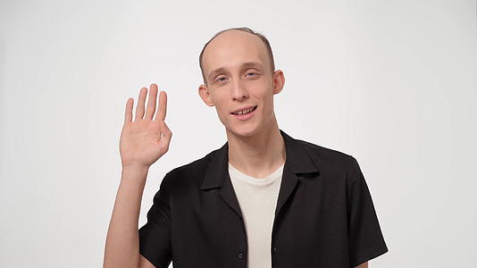 英俊的男人有头发健康问题脱发和秃顶穿着黑色的白色背景视频的预览图