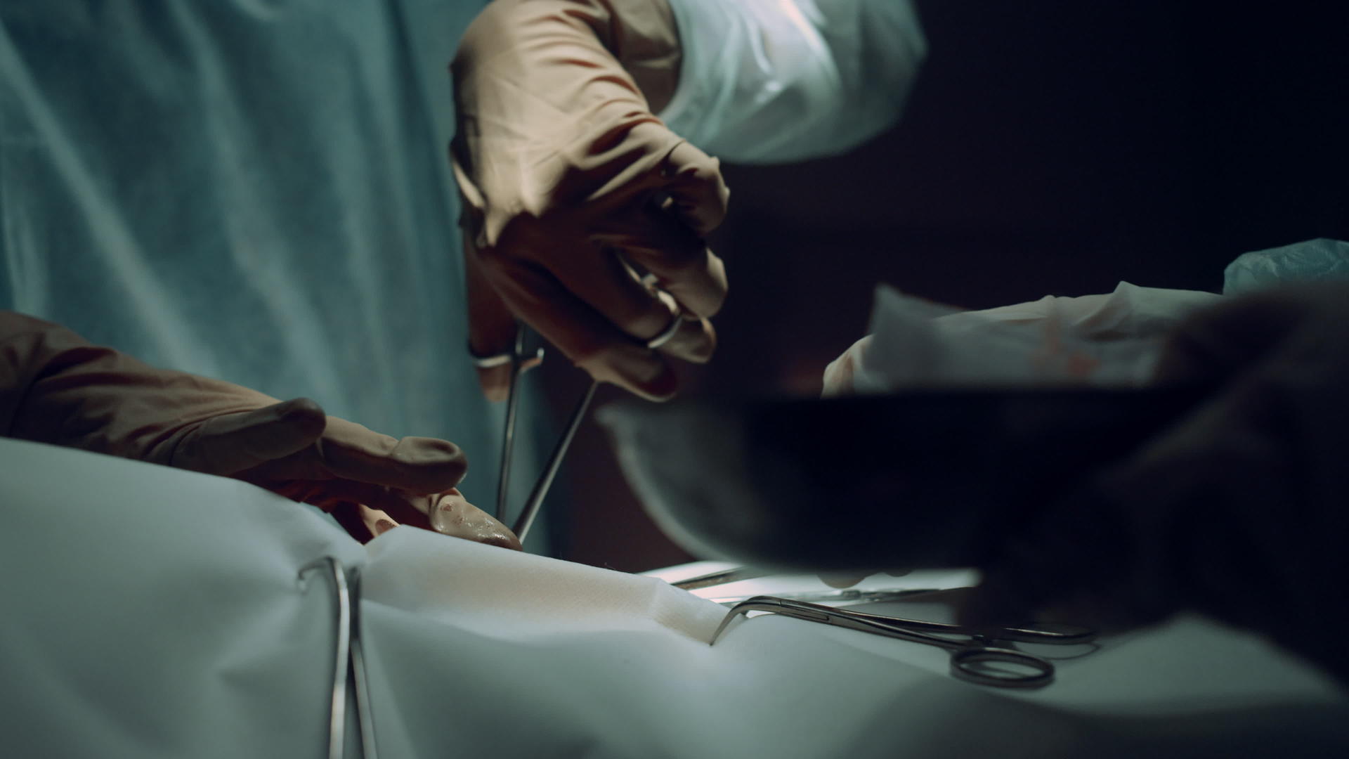 外科医生使用钳子手术室的特写手视频的预览图