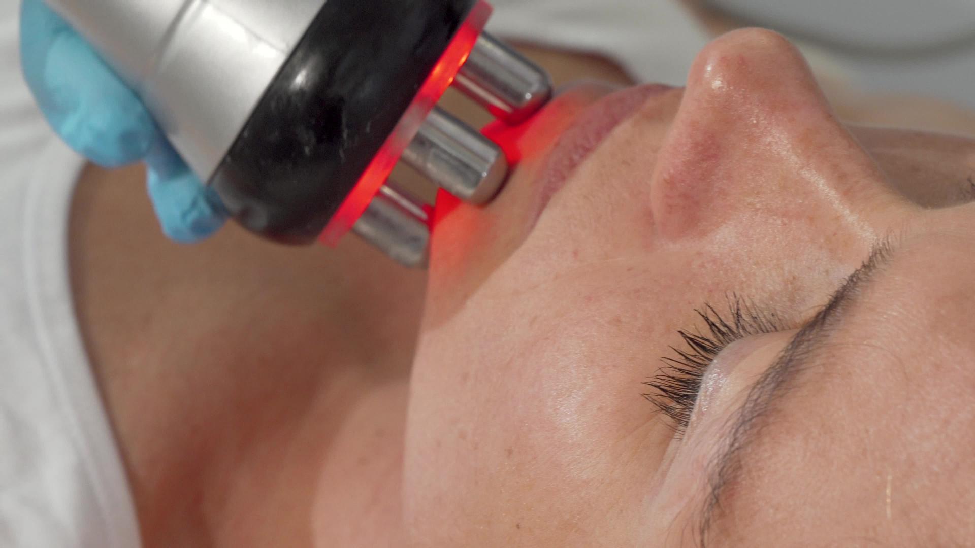 一名接受面部伸缩手术的成年女性滑轮拍摄视频的预览图