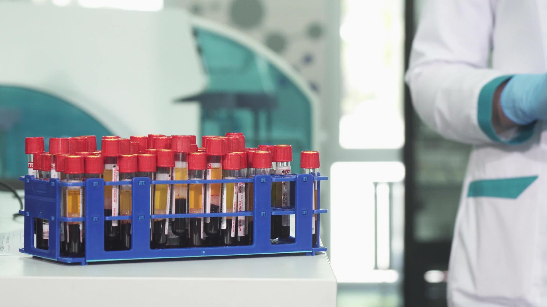 一位从事血液测试管工作的科学家视频的预览图