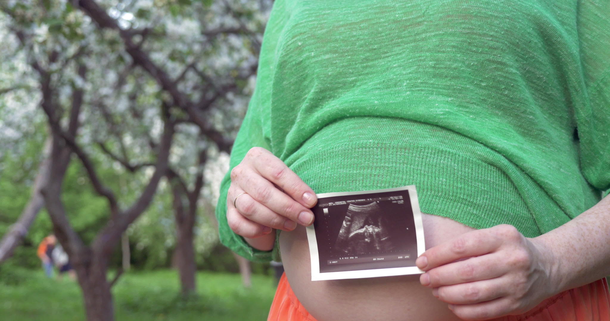 孕妇在户外扫描超声波婴儿视频的预览图