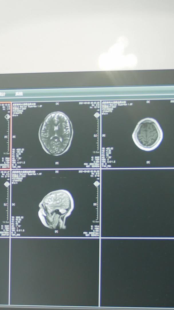 电脑屏幕实拍医疗检查结果结果视频的预览图