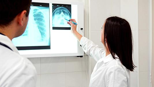 女医生铅笔在人体头部的X光片上视频的预览图