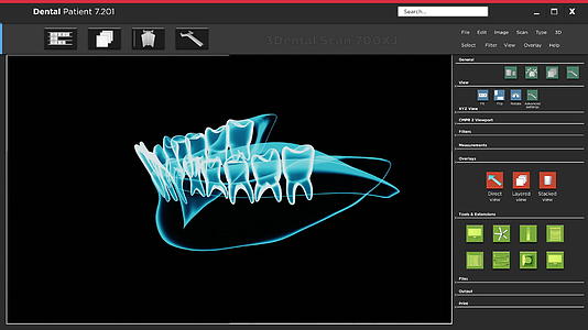 软件应用程序用户界面和牙科X光扫描接口视频的预览图