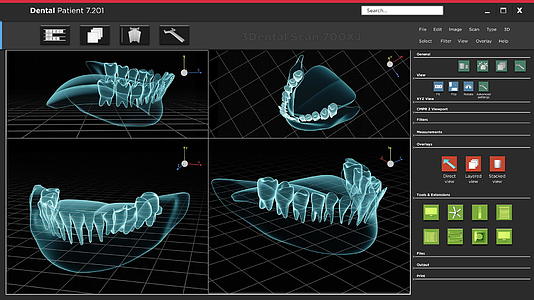 人体X光牙和扫描软件接口视频的预览图