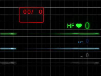 ECG无脉搏带网格4K视频的预览图