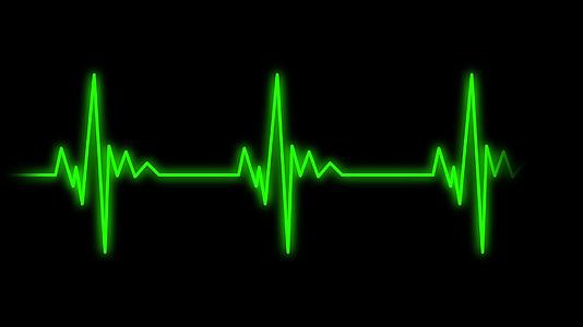 心脏的绿色心电波视频的预览图