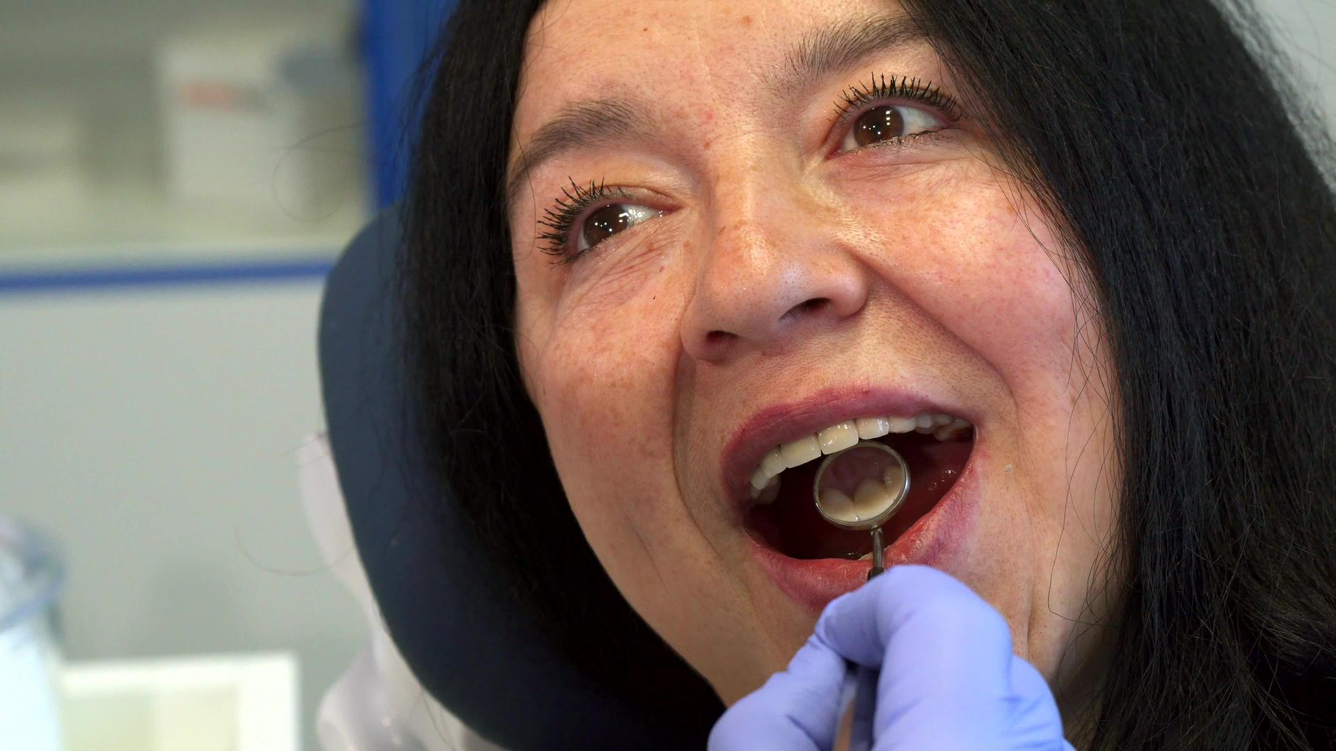 女人张开嘴做牙科检查视频的预览图