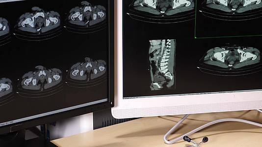 一位医生检查了胸部和腹部的照片视频的预览图