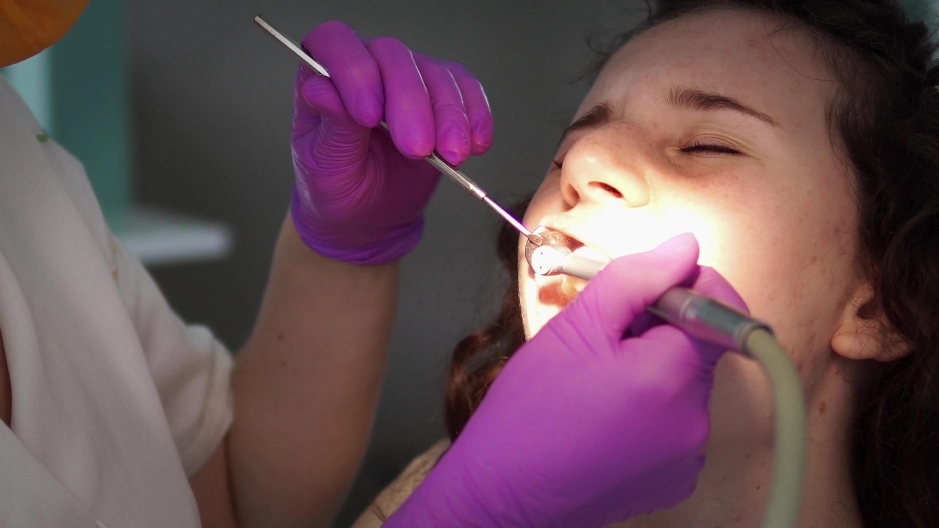 用涡轮机钻到女病人牙齿上的牙医工作视频的预览图