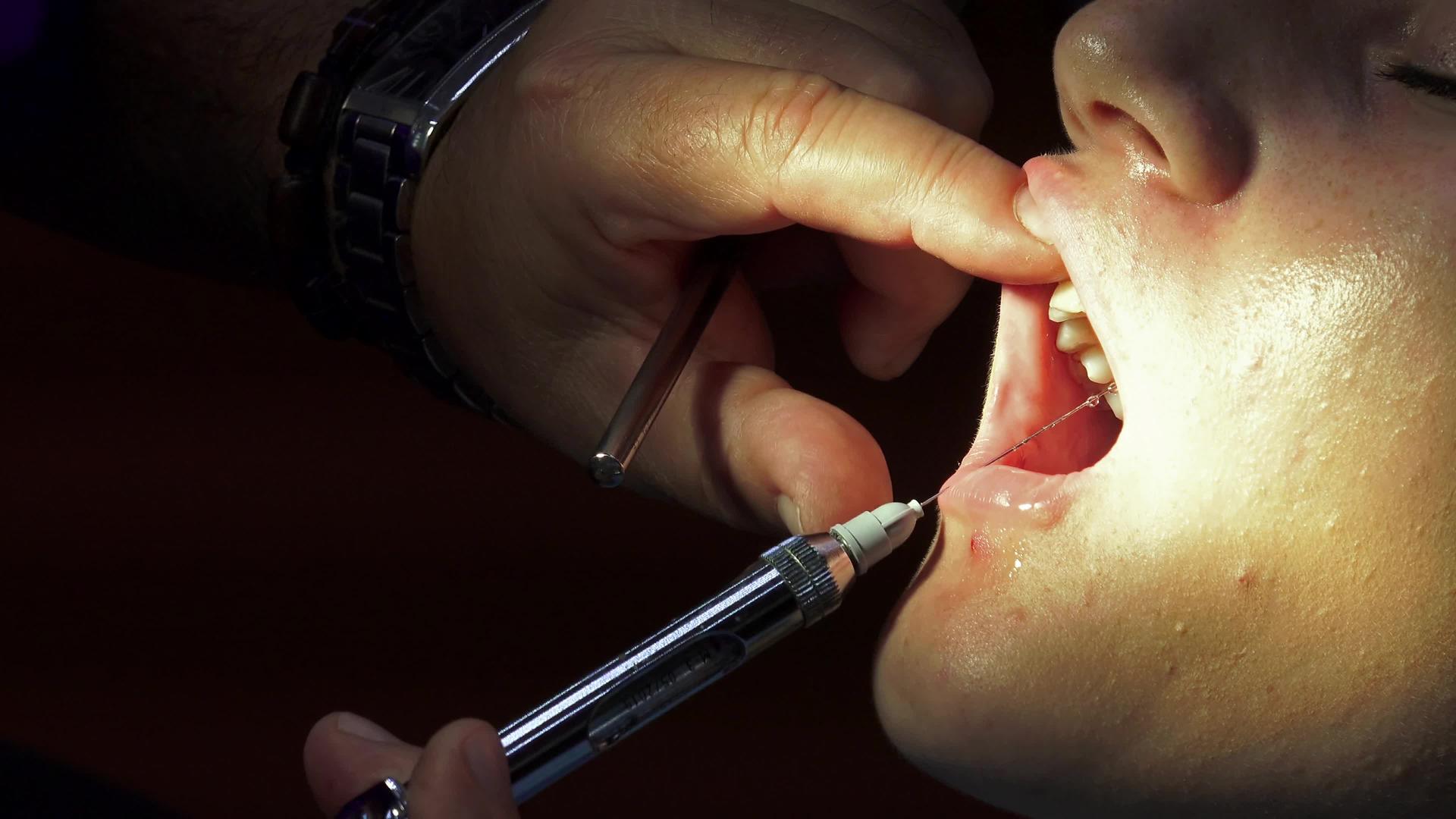 牙科手术闭合前牙科牙医进行麻醉注射视频的预览图
