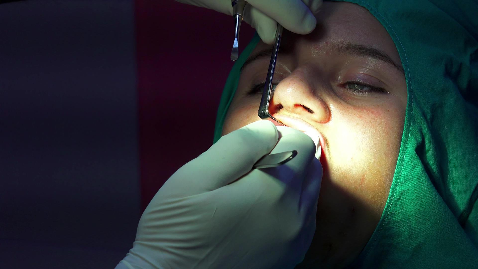牙科植牙手术视频的预览图
